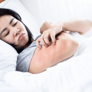 Debunking Bed Bug Myths