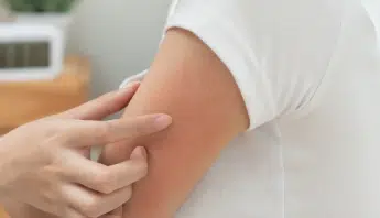 Parkland Pillows Hide Itchy Secrets