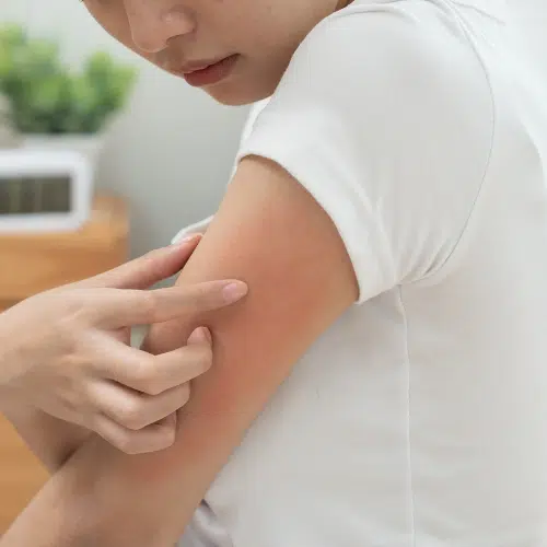 Parkland Pillows Hide Itchy Secrets